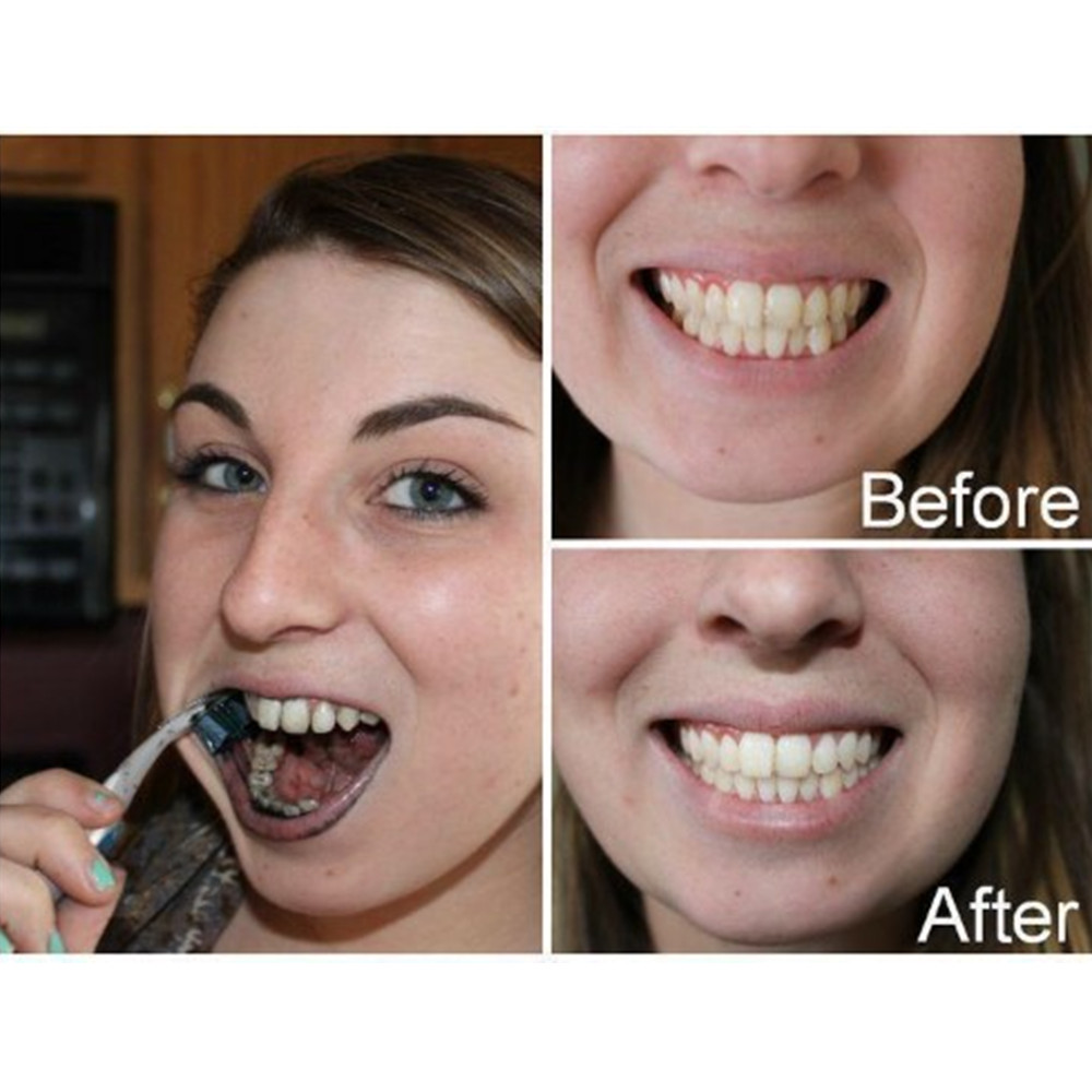 대나무 숯 치아 치아 Dentis Lab 구강 위생 관 - Teeth Whitening Vape 리뷰 및 가격