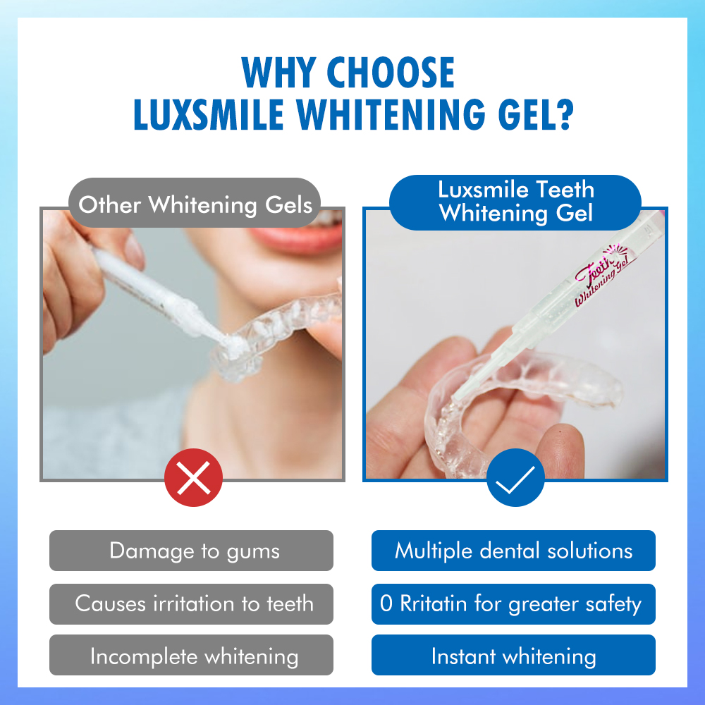 치아 미백 젤 PAP 또는 35%CP 치아 미백 젤 구 - Teeth Whitening Vape 리뷰 및 가격