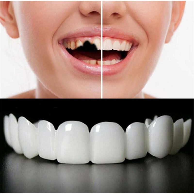 즉시 치아 미백 베니어 재사용 가능 편안한 착용감 디자 - Teeth Whitening Instant 리뷰 및 가격