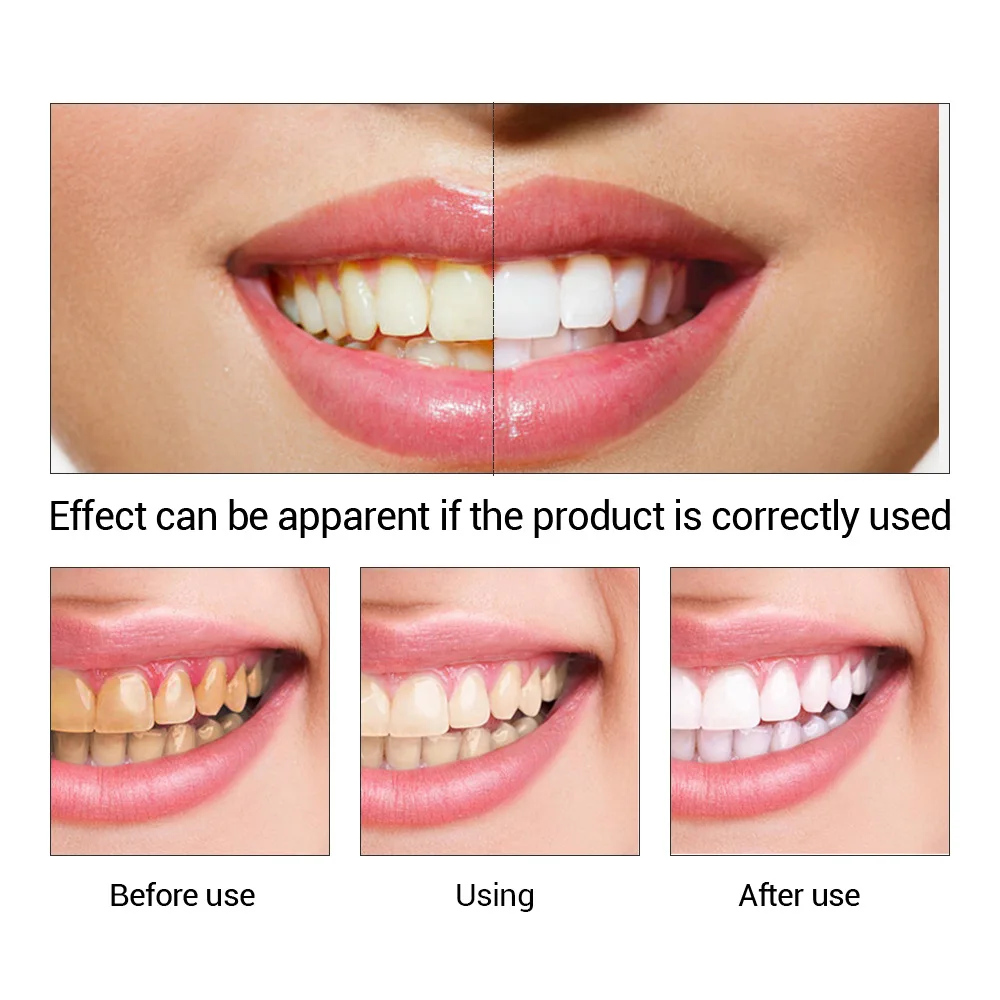 FTEENPLY 치아 미백 에센스 파우더 구강 위생 청 - Teeth Whitening Vape 리뷰 및 가격