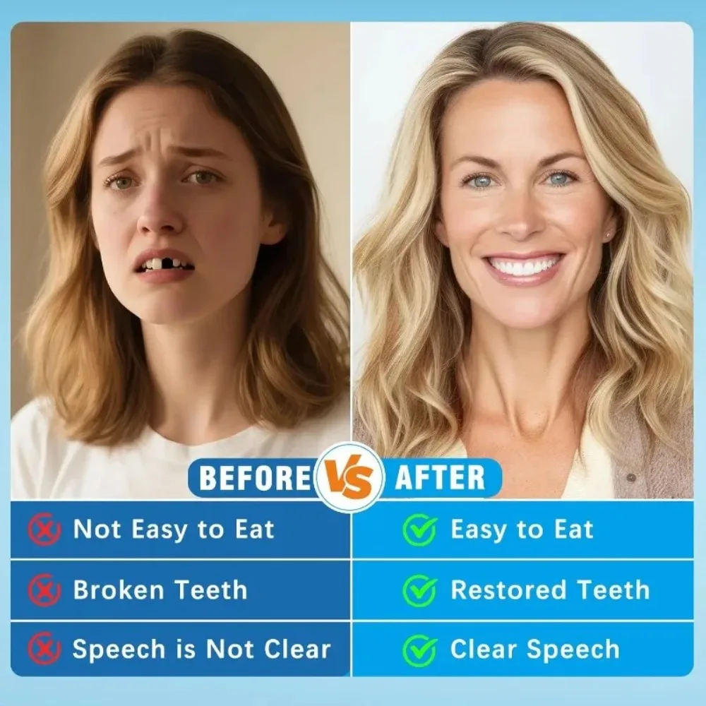 풀세트 틀니 가짜 치아 교정기 편안한 착용감 즉각적인  - Teeth Whitening Instant 리뷰 및 가격